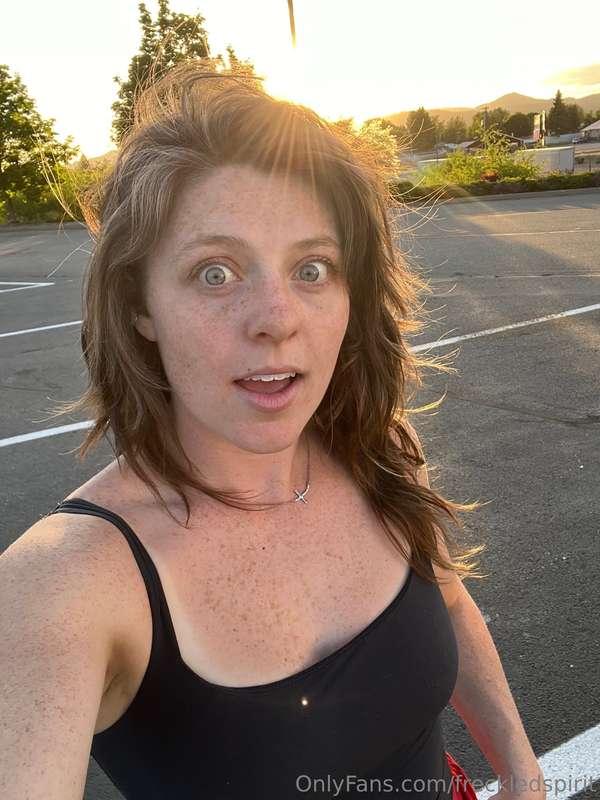 Freckles and cats 