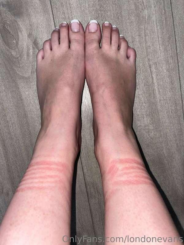French pedicure and rope marks