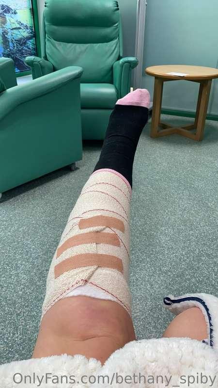Donate to my sad little princess leg and you'll get a..... F..