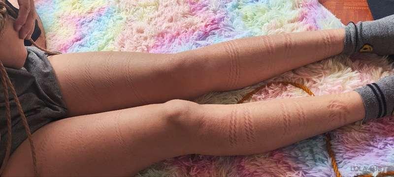 ## ✨️I just love the marks on my skin✨️