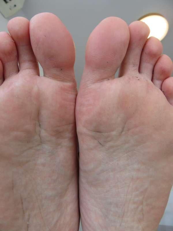 neolasoles image #22