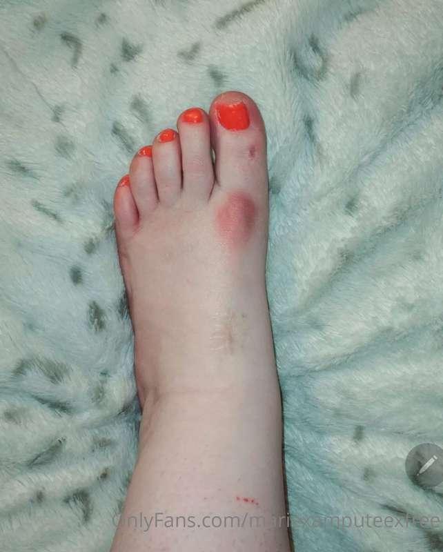 I broke my toe 😭 I hope you still like the color 😭

(Girlfri..