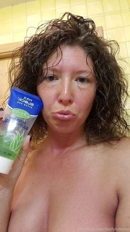 Got a little burnt yesterday 😭 who wants to help aloe my tig..