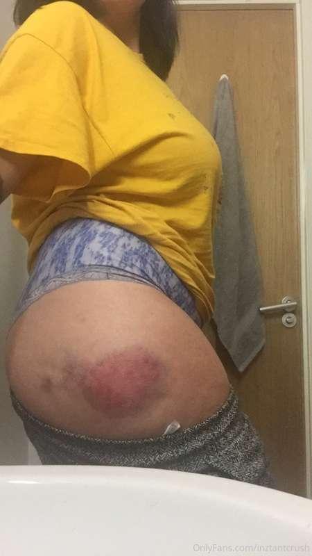 so i had a bit of a fall