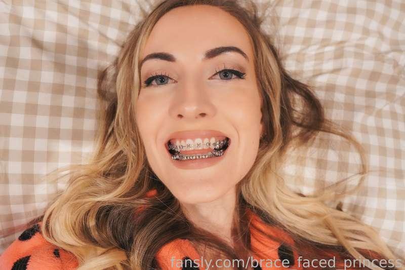 brace_faced_princess image #10