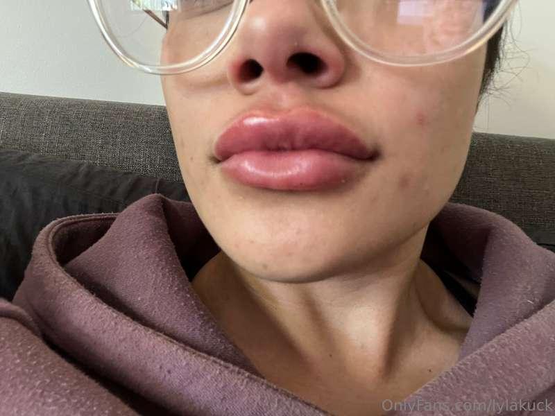 Finally got my lips done again 👅
