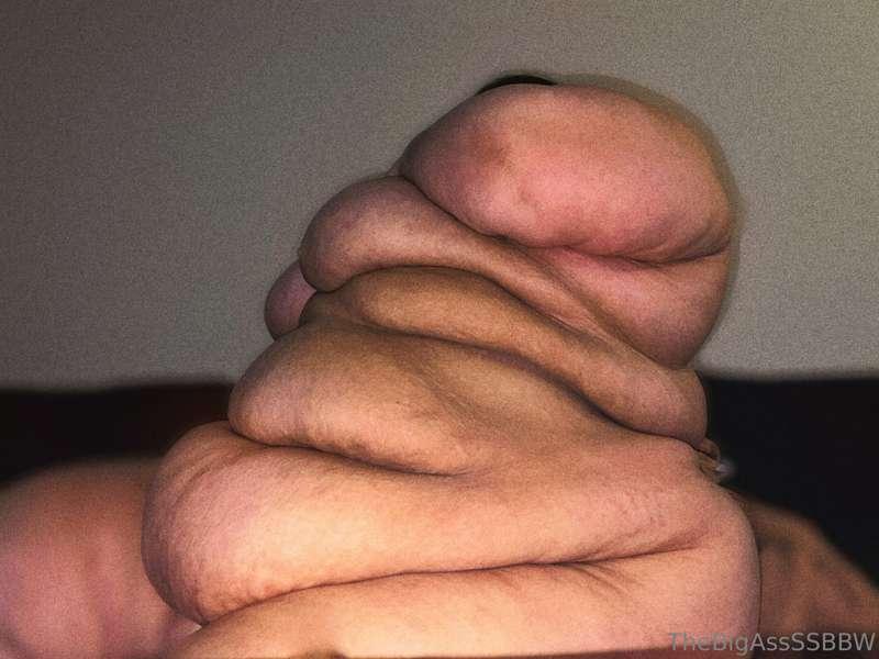Just a literal mountain of fat. Plus the fact that my huge p..