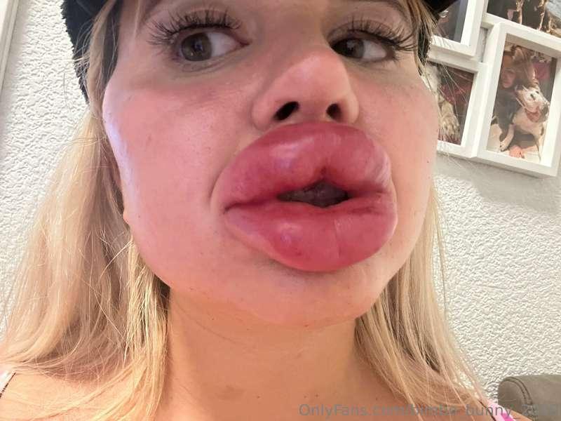 Fresh lips are the best 💖