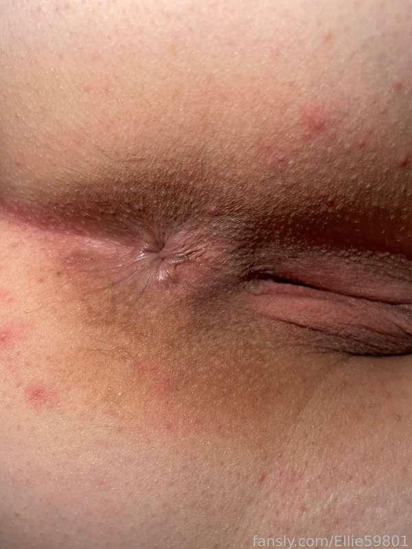 Close up of my asshole 😈💦 #fyp #asshole #tight #wetpussy #pussy #bumhole #anal #tightpussy #spread #spreading #teen #horny #pawg #anus #ass #femalesolo #labia