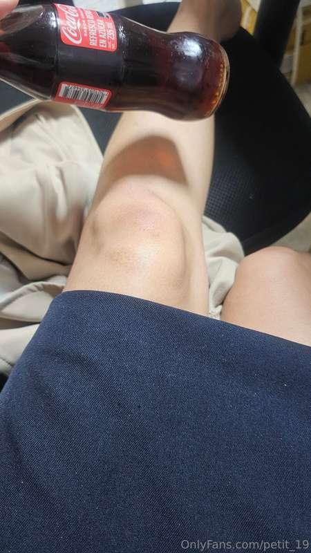 I fell 2 days ago at work guys..🥺🥺😣