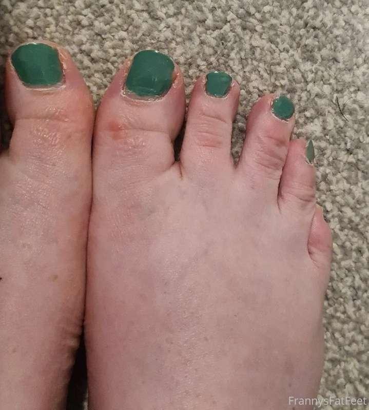 Still here with the scraggliest toes in the game..  but in g..