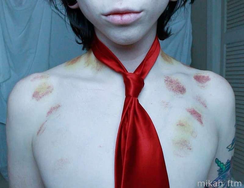 mikah_ftm image #25