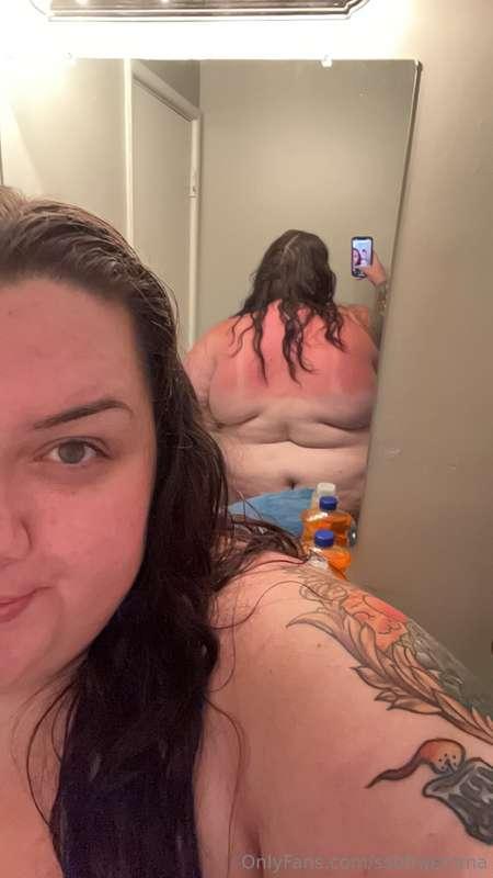 Next time do you think you could rub sunscreen on the places..