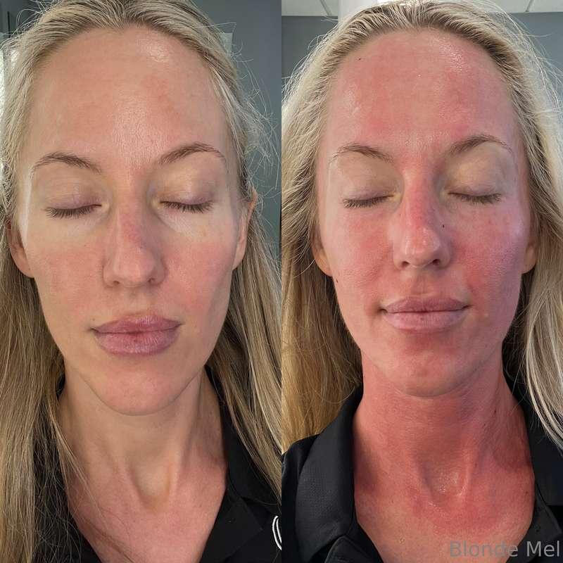 I’m a lobster again. As some of you may know I work in aesth..
