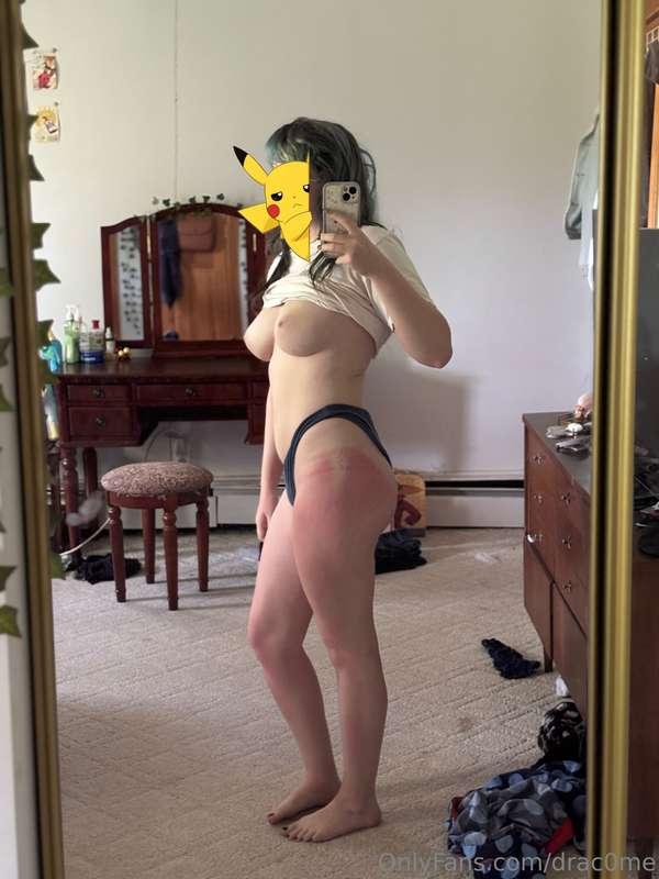 I got so sun burnt I’m in pain😭