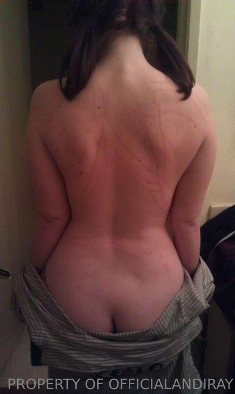 after my girlfriend scratched up my back mmmm yummy cirac 20..