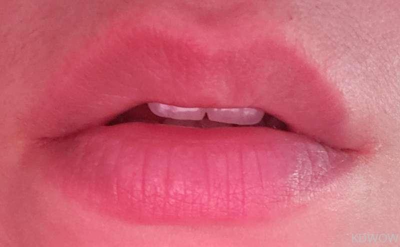My lips are so soft and pink (both sets)😝