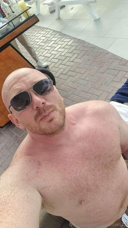 Had a few drinks yesterday burnt my head didn't have any luc..