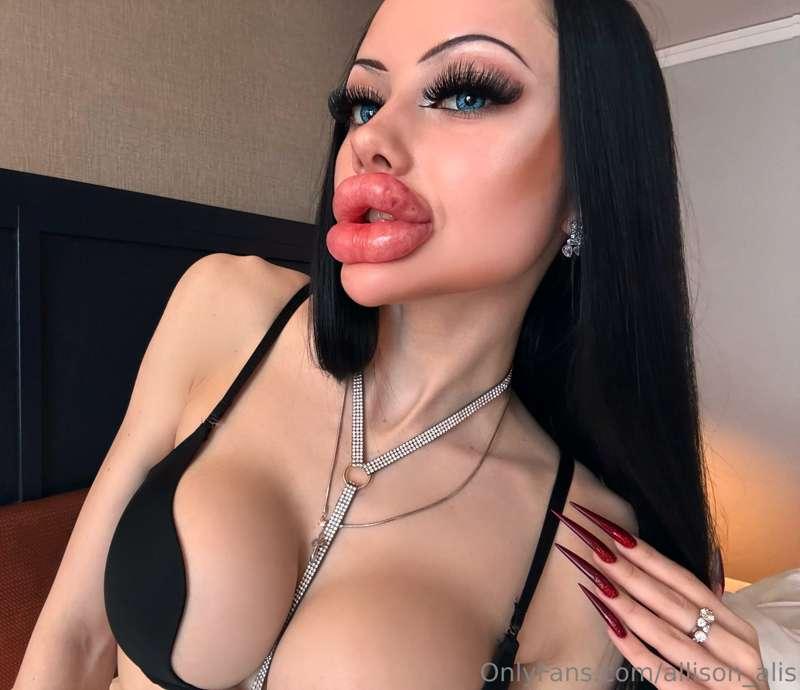MY BIGGEST LIPS EVER💋💉😍
Sexy biting my huge swollen lips 🫦 s..