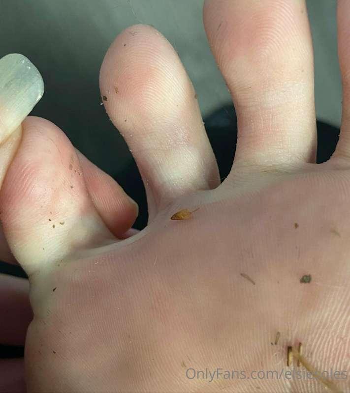 Lots to see from these feet who who trapped all day in flats..