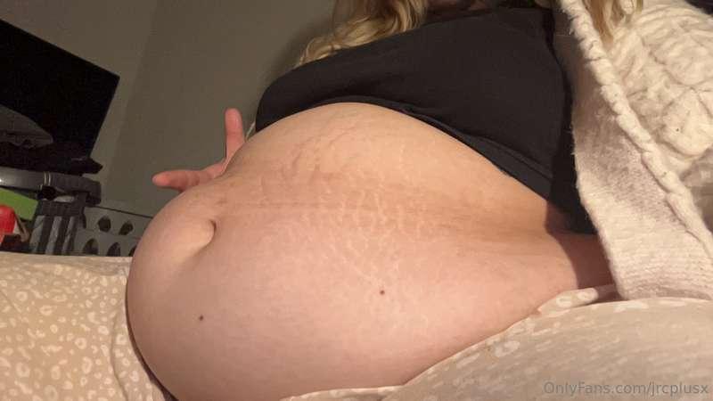 I loveee stretch marks😍
