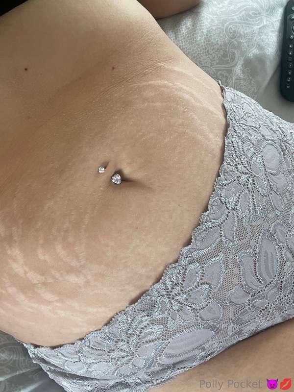 Does anybody here like stretch marks ???