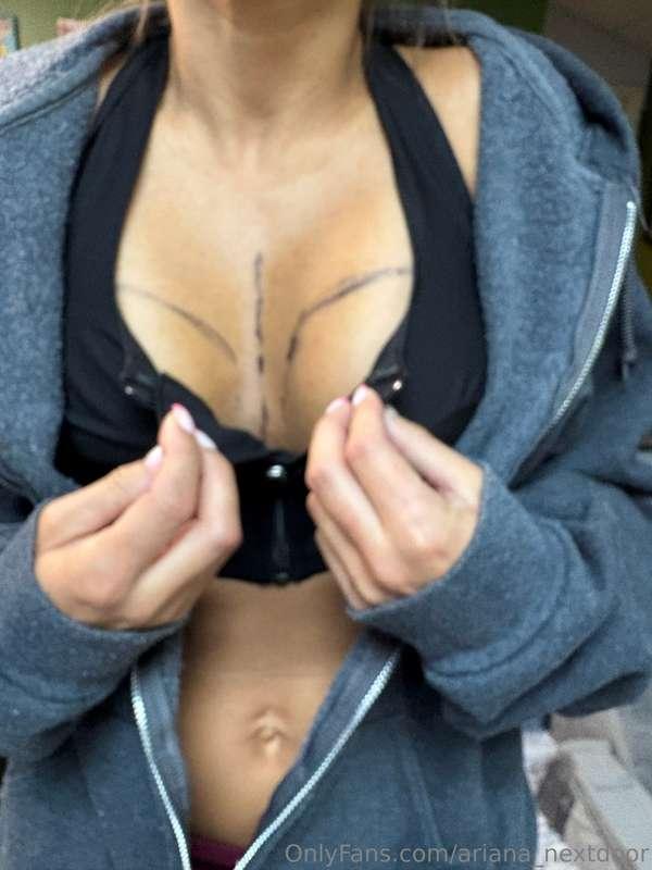 Cant wait til i can remove the bra!