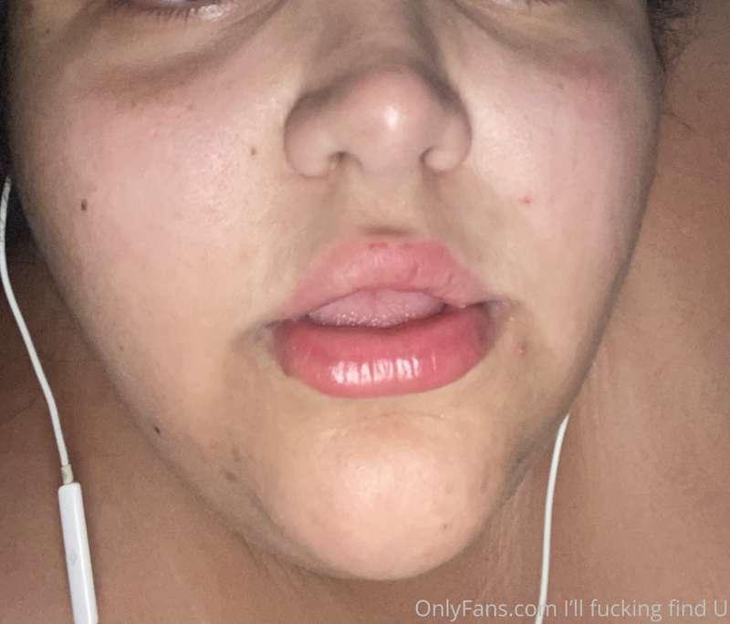 Is it lip filler? Was I in a fight? Nope my buddy is fightin..