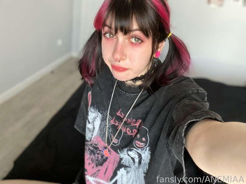 anemiaa image #1