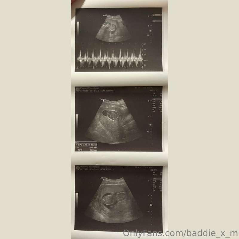 ❤️🥰🤰🏻I got to see their tiny toes on the Doppler ❤️ and hear..