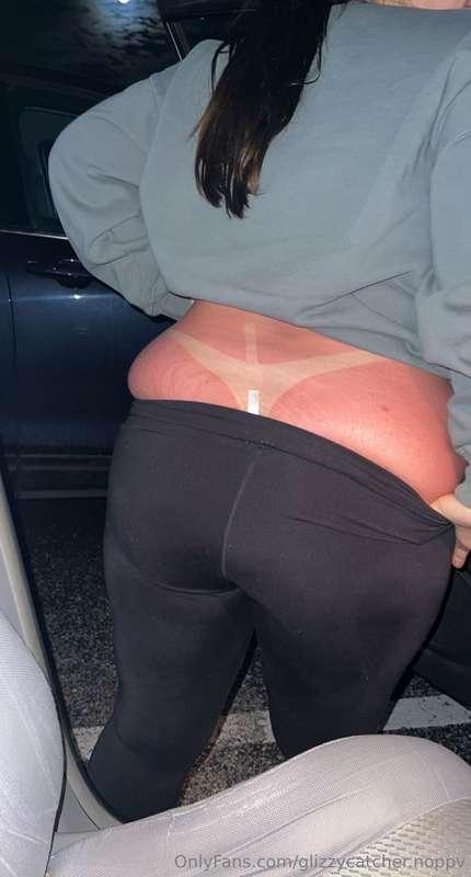 i got so burnt omggg