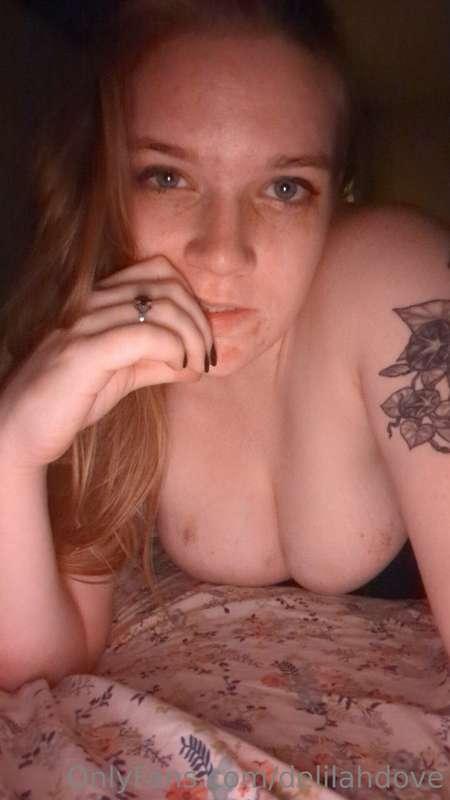 Who likes bruises?? I do!