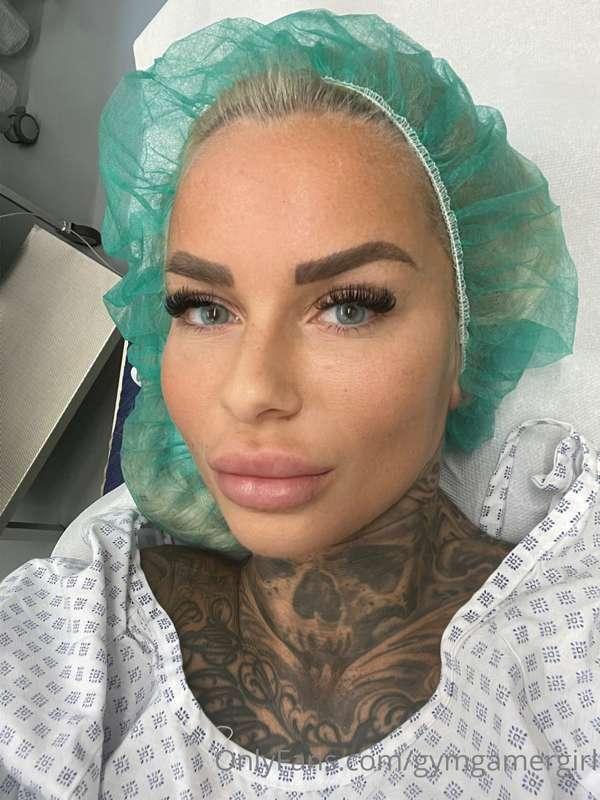 Today was my pussy surgery 😍😍😍 they cut my inner lips mostly..