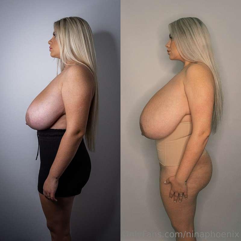 2021. vs 2025.The rest of my body is almost the same. 🥰 I lo..