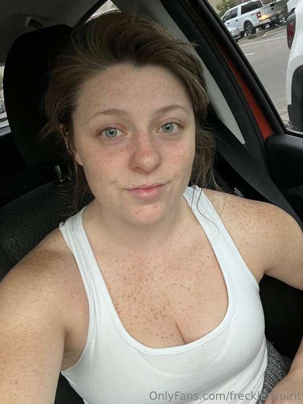 Just freckles