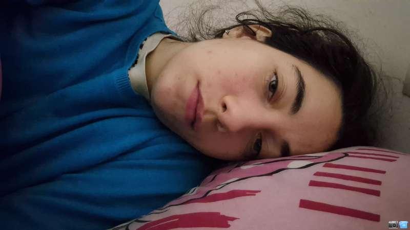 Pure il sole mi dà fastidio