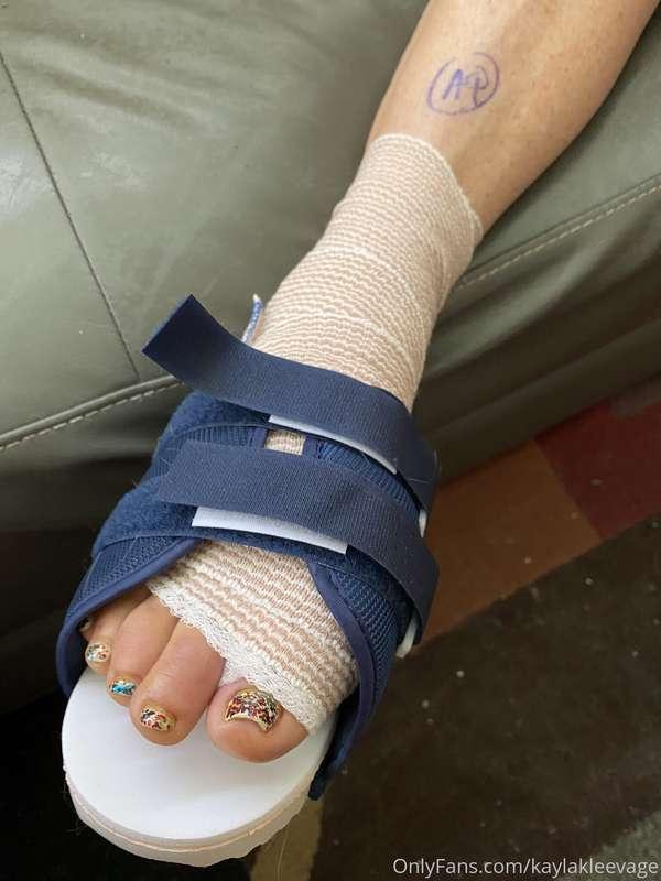 Had surgery on my right foot so I'm kinda on the DL recoveri..