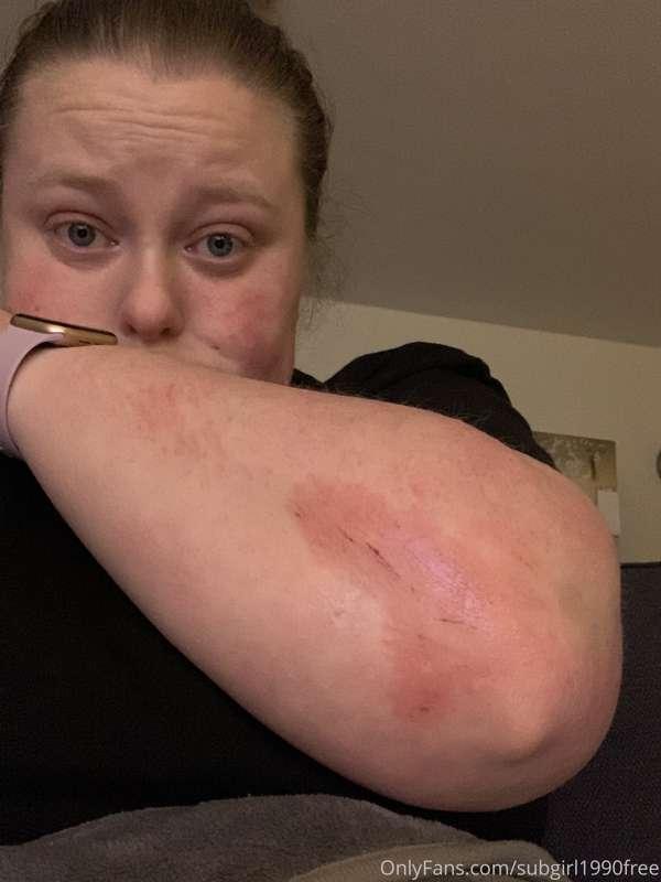 Have some patience with me I may have fallen down the stairs..