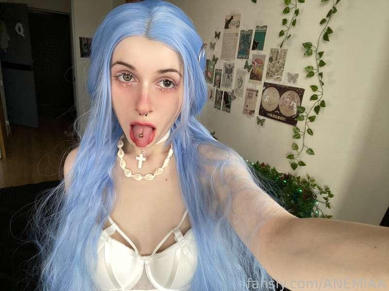anemiaa image #0