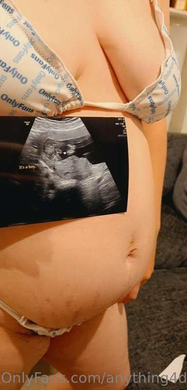 For those that missed the live. I'm having a boy this time! ..