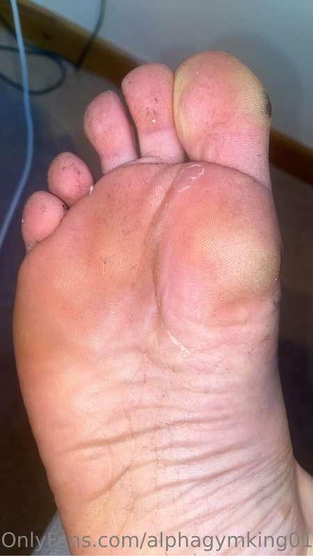 Sweaty feet