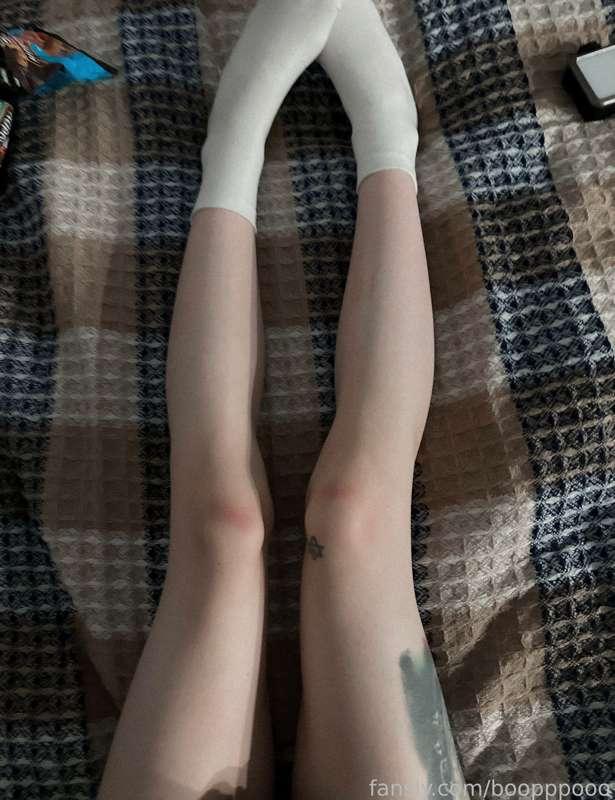 Love for bruises 💔

#bruises #fyp #legs #socks #fetishfriendly #bdsm #submissive #tattooed 