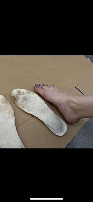 Sweaty Asian feet