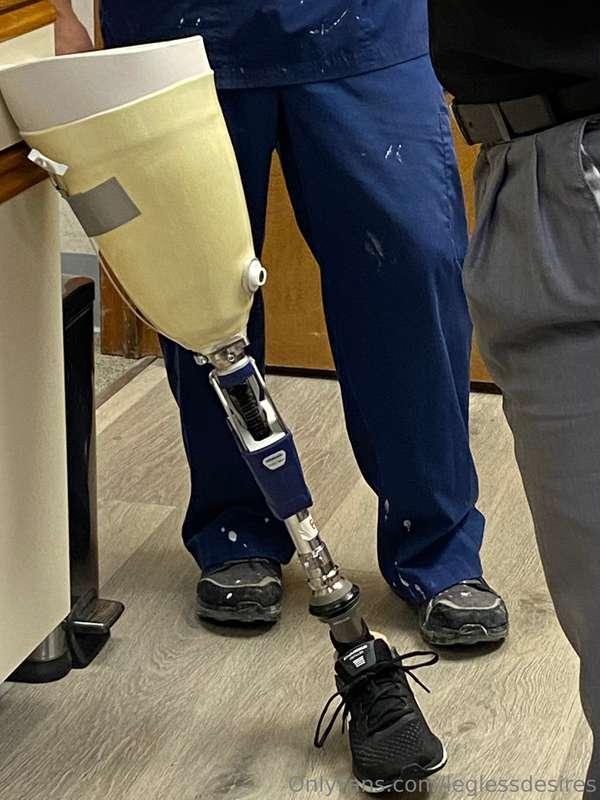 When I was being fitted for the very first leg/socket. 