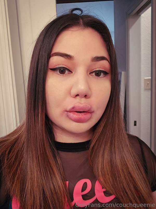 One day after fillers 😈