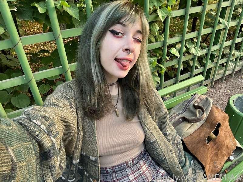 anemiaa image #1