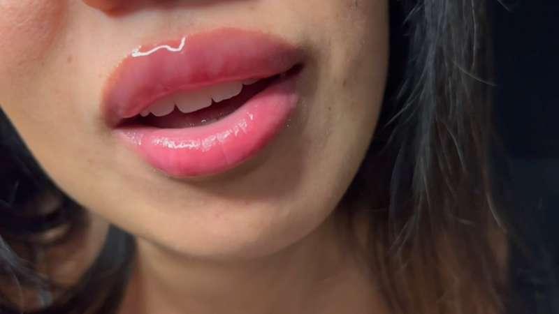 Kiss me 