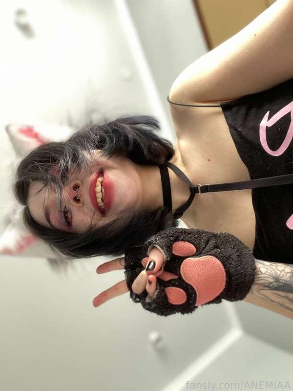 anemiaa image #2
