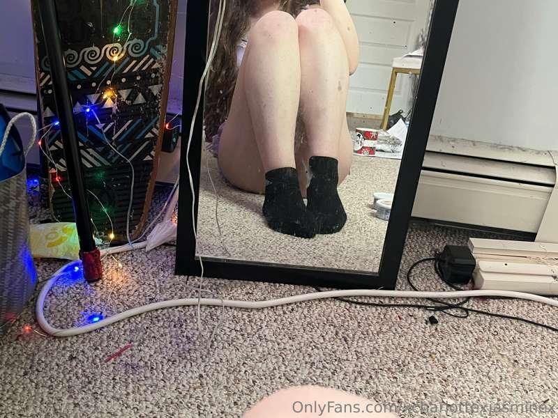 I bruise so easily :(