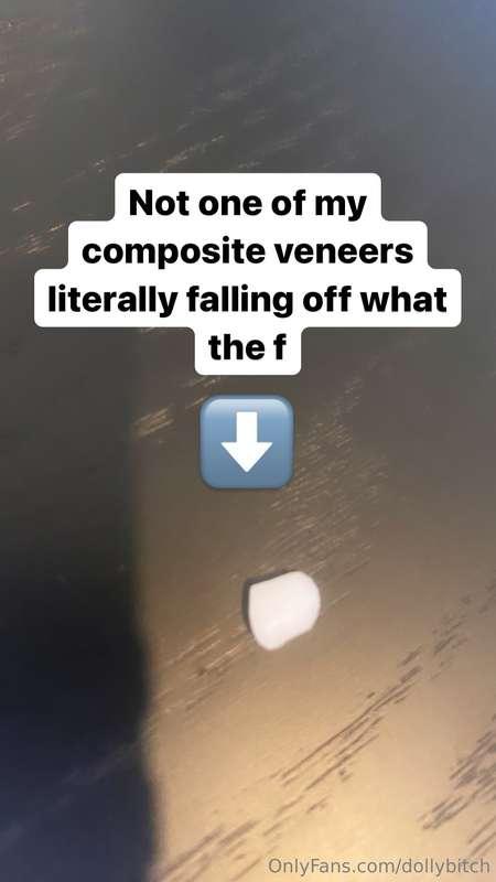 Any dentists want to give me free dental work otherwise it’s..